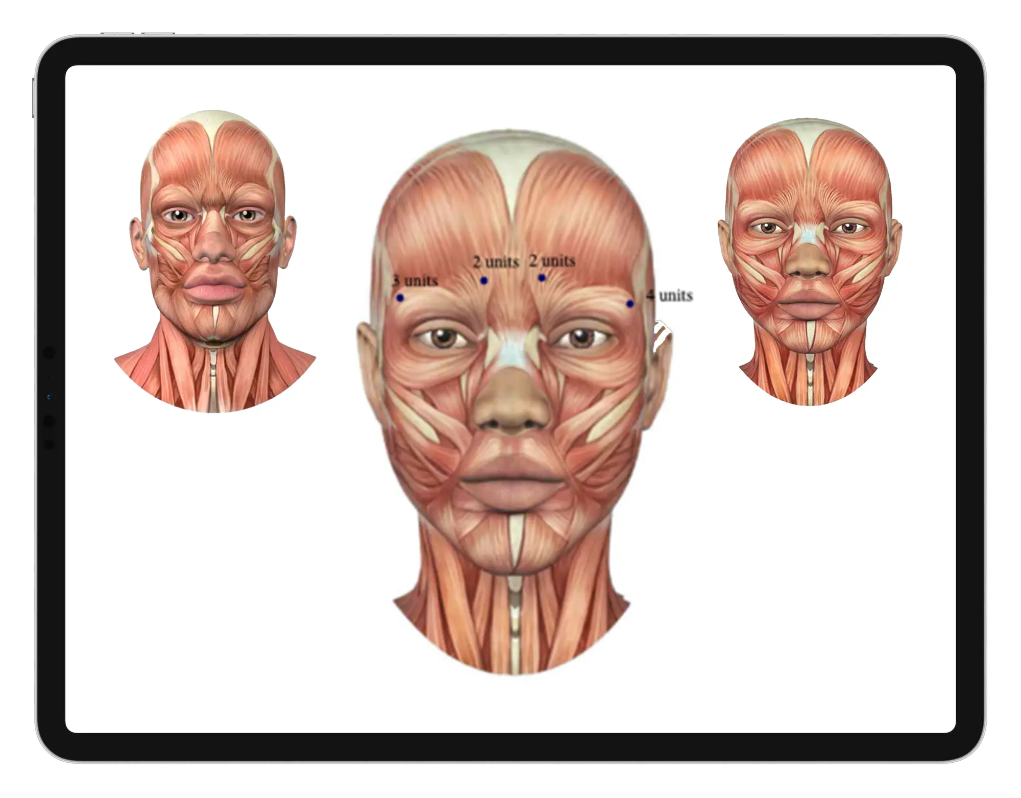 Annotatable Images to Record Injections and Quantities